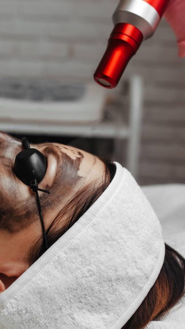 CARBON FACIAL